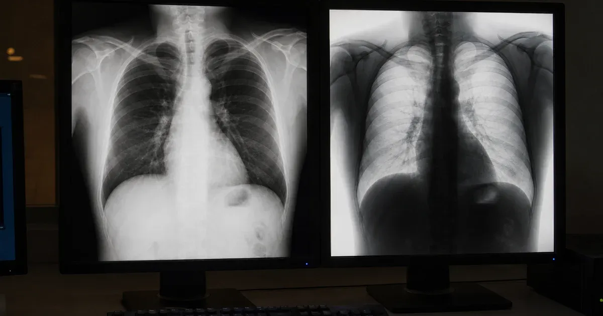 MONOCHROME1 vs MONOCHROME2: Inverted DICOM Images