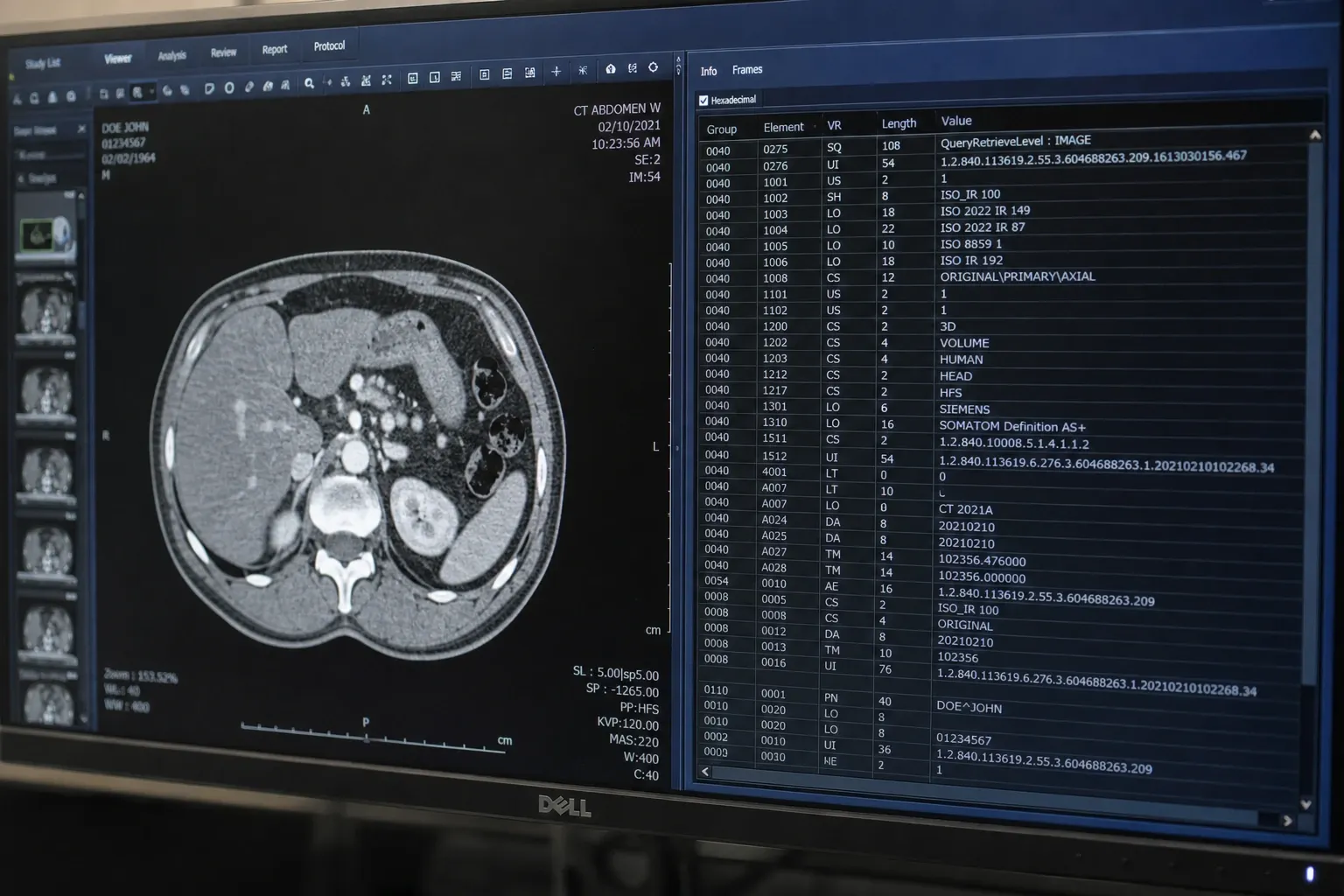 DICOM Private Tags Explained